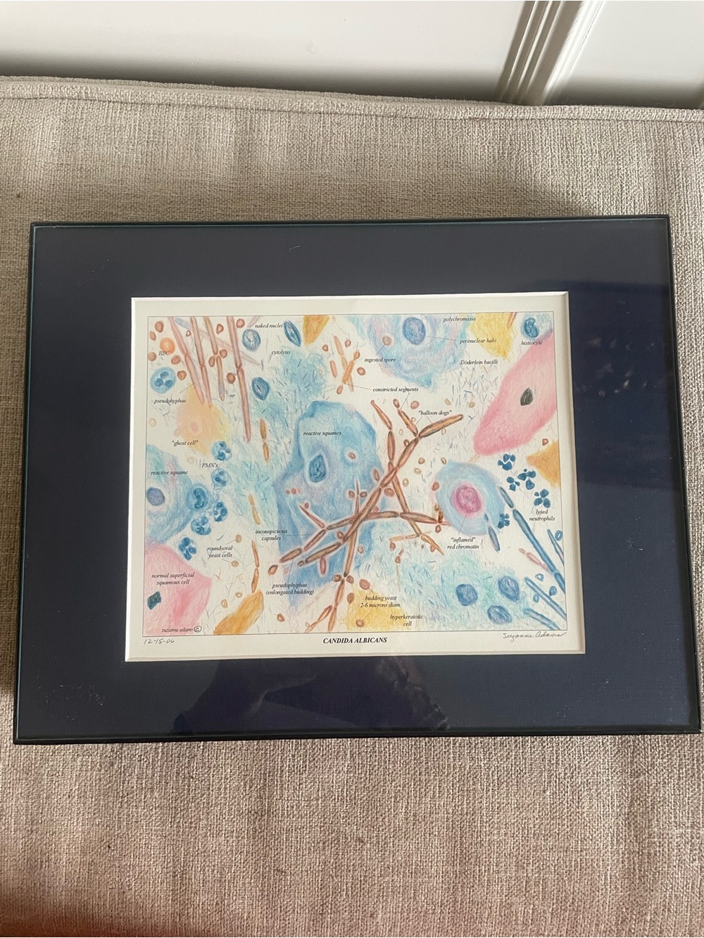 3 cytology prints matted and framed by Suzanne Adams